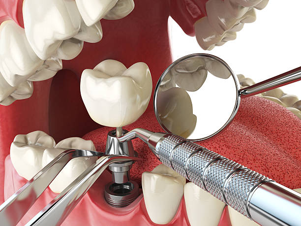 Best Walk-In Emergency Dentist in Colfax, IA